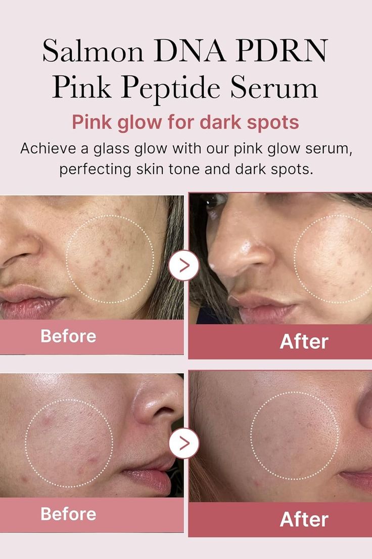 SERUM COREANO DE SALMON MEDICUBE PDRN