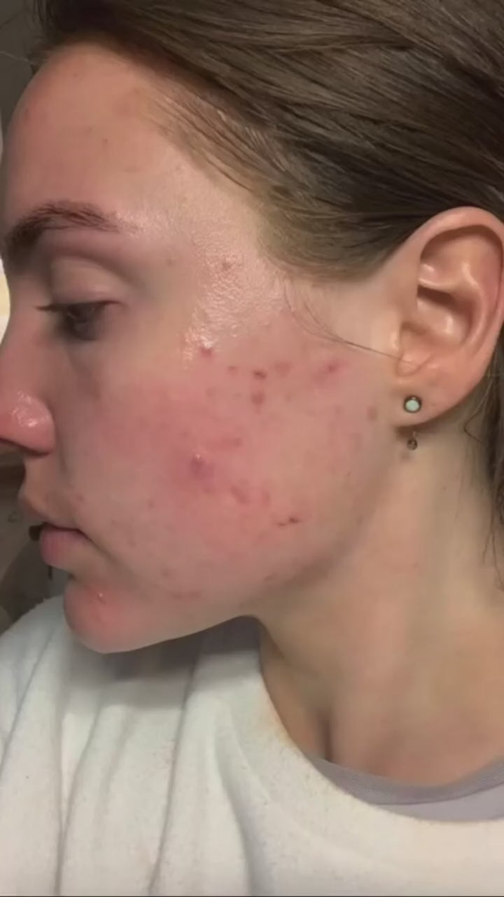 ANUA SERUM COREANO 30 ML